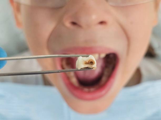 Emergency Dentist Open Today in MT